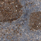 Anti-RIOK2 Antibody