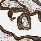 Anti-RIOK2 Antibody