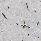 Immunohistochemical staining of human cerebral cortex shows strong cytoplasmic positivity in endothelial cells.