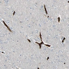 Immunohistochemical staining of human cerebral cortex shows strong cytoplasmic positivity in endothelial cells.