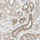 Immunohistochemical staining of human kidney shows moderate membranous positivity in a subset of cells in tubules.