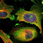 Immunofluorescent staining of human cell line U-251 MG shows localization to plasma membrane & cytosol.