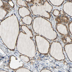 Anti-QSER1 Antibody