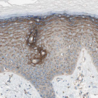 Immunohistochemical staining of human skin shows strong cytoplasmic granular positivity in squamous epithelial cells.