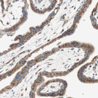 Immunohistochemical staining of human placenta shows strong cytoplasmic granular positivity in trophoblastic cells.