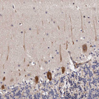 Immunohistochemical staining of human cerebellum shows strong cytoplasmic positivity in Purkinje cells.