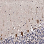 Immunohistochemical staining of human cerebellum shows strong cytoplasmic positivity in Purkinje cells.