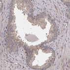 Immunohistochemical staining of human prostate shows weak cytoplasmic positivity in glandular cells.