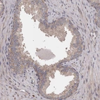 Immunohistochemical staining of human prostate shows weak cytoplasmic positivity in glandular cells.