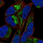Immunofluorescent staining of human cell line RH-30 shows localization to nucleus & mitochondria.
