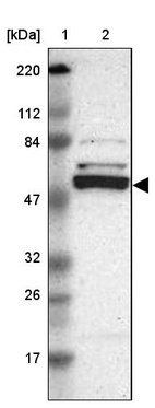 Lane 1: Marker [kDa] 220, 112, 84, 47, 32, 26, 17_br/_Lane 2: Human cell line RT-4