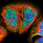 Immunofluorescent staining of human cell line A-431 shows positivity in nucleus & cytoplasm.