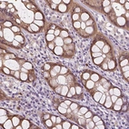 Immunohistochemical staining of human colon shows moderate cytoplasmic positivity in glandular cells.