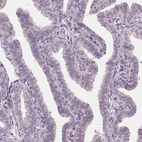 Immunohistochemical staining of human fallopian tube shows no positivity in glandular cells as expected.