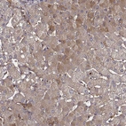 Immunohistochemical staining of human liver shows moderate cytoplasmic positivity in hepatocytes.