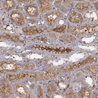 Immunohistochemical staining of human kidney shows strong positivity in plasma in cells in tubules.