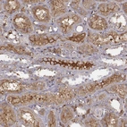 Immunohistochemical staining of human kidney shows strong positivity in plasma in cells in tubules.