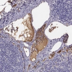 Immunohistochemical staining of human lymph node shows strong positivity in plasma in non-germinal center cells.