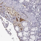 Immunohistochemical staining of human duodenum shows strong positivity in plasma in glandular cells.