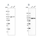 Anti-TF Antibody