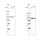 Western blot analysis using Anti-TF antibody HPA005692 (A) shows similar pattern to independent antibody HPA001527 (B).