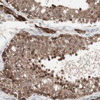 Anti-PTPA Antibody