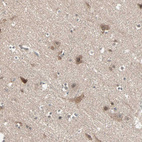 Immunohistochemical staining of human cerebral cortex shows moderate cytoplasmic and nuclear positivity in neuronal cells.