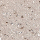 Immunohistochemical staining of human cerebral cortex shows moderate cytoplasmic and nuclear positivity in neuronal cells.