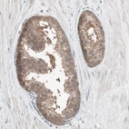 Immunohistochemical staining of human prostate shows moderate cytoplasmic positivity in glandular cells.