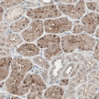 Immunohistochemical staining of human kidney shows moderate cytoplasmic and nuclear positivity in cells in tubules.