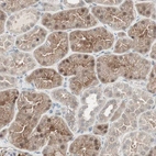 Immunohistochemical staining of human kidney shows moderate cytoplasmic and nuclear positivity in cells in tubules.