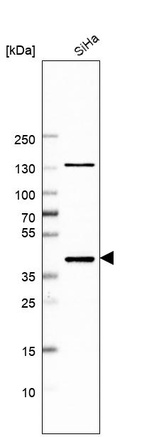 Western blot analysis in human cell line SiHa.