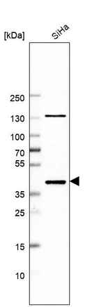 Western blot analysis in human cell line SiHa.