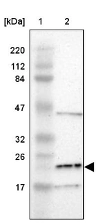 Lane 1: Marker [kDa] 220, 112, 84, 47, 32, 26, 17_br/_Lane 2: Human cell line RT-4
