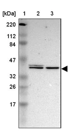 Lane 1: Marker [kDa] 220, 112, 84, 47, 32, 26, 17_br/_Lane 2: Human cell line RT-4_br/_Lane 3: Human cell line U-251MG sp