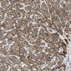 Anti-PRELID1 Antibody