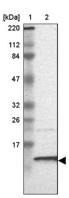 Lane 1: Marker [kDa] 220, 112, 84, 47, 32, 26, 17_br/_Lane 2: Human cell line RT-4
