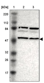 Lane 1: Marker [kDa] 220, 112, 84, 47, 32, 26, 17_br/_Lane 2: Human cell line RT-4_br/_Lane 3: Human cell line U-251MG sp