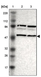 Lane 1: Marker [kDa] 220, 112, 84, 47, 32, 26, 17_br/_Lane 2: Human cell line RT-4_br/_Lane 3: Human cell line U-251MG sp