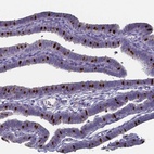 Immunohistochemical staining of human fallopian tube shows strong nuclear positivity in a subset of glandular cells.