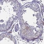 Immunohistochemical staining of human testis shows moderate nuclear positivity in a subset of cells in seminiferous ducts.