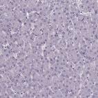 Immunohistochemical staining of human liver shows no positivity as expected.