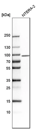 Western blot analysis in human cell line NTERA-2.