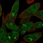 Immunofluorescent staining of human cell line RH-30 shows localization to nucleoplasm & the Golgi apparatus.