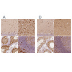 Anti-FSCN1 Antibody