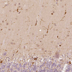 Anti-FSCN1 Antibody