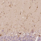 Immunohistochemical staining of human cerebellum shows strong cytoplasmic positivity in cells in molecular layer.