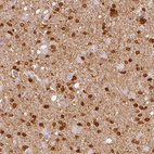 Anti-FSCN1 Antibody