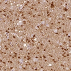 Immunohistochemical staining of human cerebral cortex shows strong cytoplasmic positivity in glial cells.