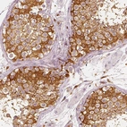 Immunohistochemical staining of human testis shows strong cytoplasmic positivity in cells in seminiferous ducts.